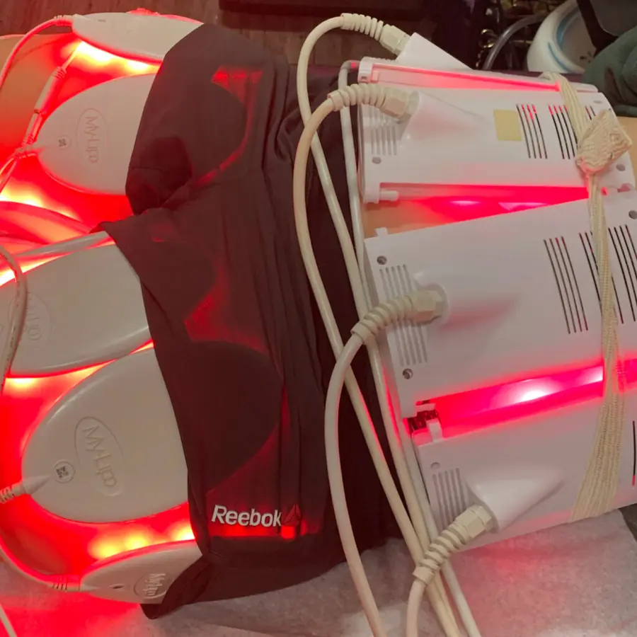 Laser Lipo